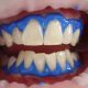 הלבנת שיניים איזה שיטות קימות?
